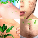 Catt & Co Scar Removal Serum